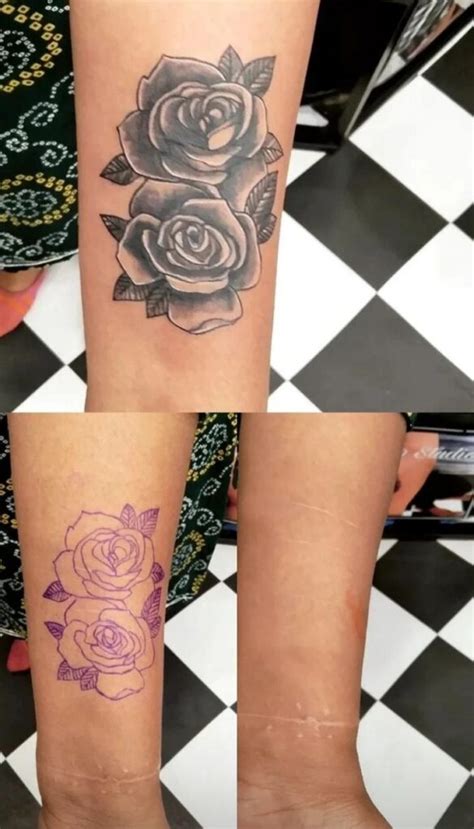 dallas best tattoo studio for scars